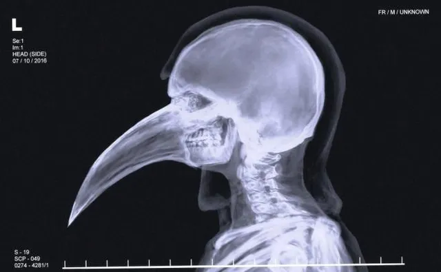SCP-049 · Plague Doctor