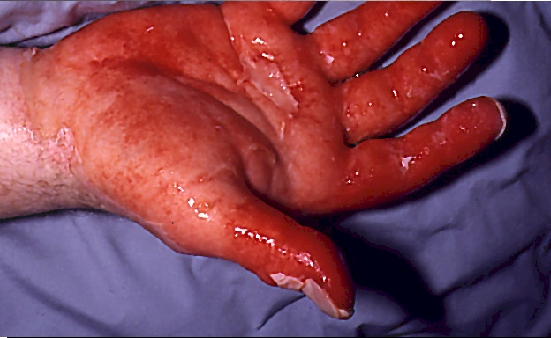 SCP-734 · The Baby